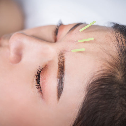 Skin Rejuv, Sans Filler/Botox